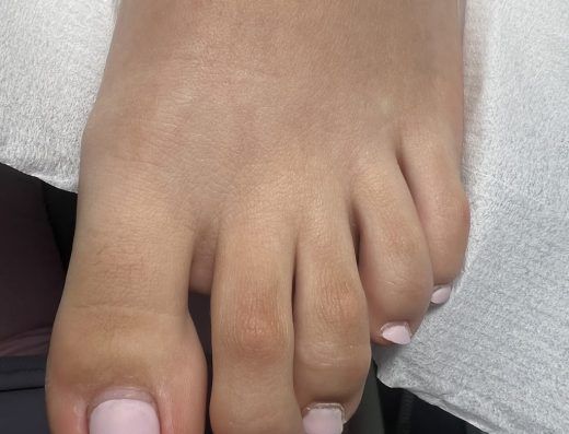 Pedichiura cu nota medicala Bucuresti-Happy Feet Medical